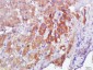 Calmodulin 1/2/3 Rabbit pAb